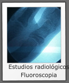 Estudios radiológicos Fluoroscopia
